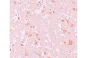 Immunohistochemical staining of human brain cells with NLRP7 polyclonal antibody  at 10 ug/mL. (NLRP7 antibody  (N-Term))