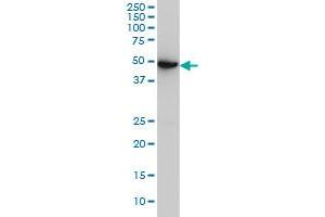 ASB10 monoclonal antibody (M02), clone 1F3 Western Blot analysis of ASB10 expression in A-431 . (ASB10 antibody  (AA 48-153))