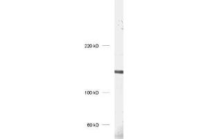 dilution: 1 : 1000, sample: rat hippocampus homogenate (UBE3B antibody)