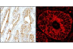 Immunohistochemistry (IHC) image for anti-MAP-Kinase Activating Death Domain (MADD) (AA 1597-1647) antibody (ABIN7455235)