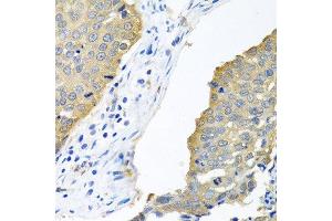 Immunohistochemistry (Paraffin-embedded Sections) (IHC (p)) image for anti-Eukaryotic Translation Initiation Factor 4E (EIF4E) (AA 1-100) antibody (ABIN3023085)