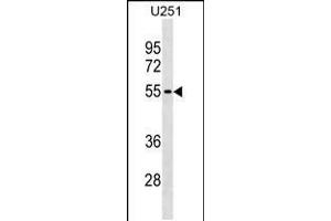 Western blot analysis in U251 cell line lysates (35ug/lane). (KLHDC7B antibody  (C-Term))