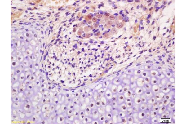 HMGN5 antibody  (AA 201-282)