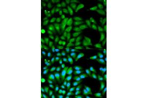 Immunofluorescence (IF) image for anti-Parkinson Protein 2, E3 Ubiquitin Protein Ligase (Parkin) (PARK2) (AA 1-300) antibody (ABIN3021179)