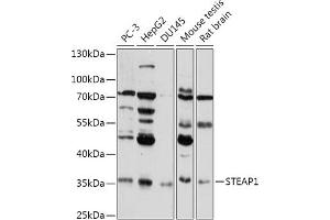Western blot analysis of extracts of various cell lines, using STE antibody (ABIN7270331) at 1:1000 dilution.