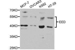 Western Blotting (WB) image for anti-Embryonic Ectoderm Development (EED) antibody (ABIN1876559)