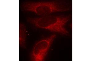 Immunofluorescence staining of methanol-fixed HeLa cells using Phospho-YWHAZ-S58 antibody (ABIN2987575). (14-3-3 zeta antibody  (pSer58))
