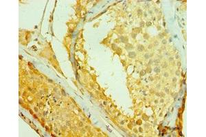 Immunohistochemistry of paraffin-embedded human testis tissue using ABIN7147263 at dilution of 1:100 (RAD1 antibody  (AA 1-282))