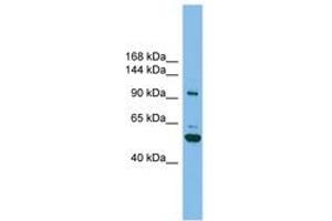 Image no. 1 for anti-SH3-Domain Binding Protein 4 (SH3BP4) (AA 71-120) antibody (ABIN6745080) (SH3BP4 antibody  (AA 71-120))