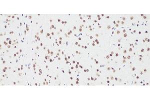 Immunohistochemistry of paraffin-embedded Rat brain using Bcl9 Polyclonal Antibody at dilution of 1:100 (20x lens). (BCL9 antibody)