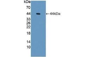 Detection of Recombinant PTI, Human using Polyclonal Antibody to Placental Thrombin Inhibitor (PTI)