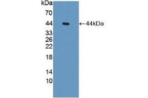 Detection of Recombinant PTI, Human using Polyclonal Antibody to Placental Thrombin Inhibitor (PTI) (SERPINB6 antibody  (AA 1-376))