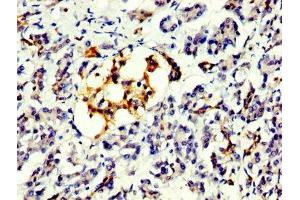 IHC image of ABIN7164077 diluted at 1:300 and staining in paraffin-embedded human pancreatic tissue performed on a Leica BondTM system. (PRDM1 antibody  (AA 1-122))