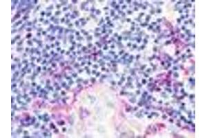 Anti-CMKLR1 antibody IHC of human thymus. (CMKLR1 antibody  (N-Term))