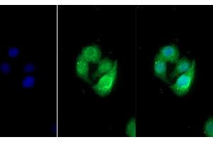 Detection of UMOD in Human Hela cell using Polyclonal Antibody to Uromodulin (UMOD) (Uromodulin antibody  (AA 334-589))