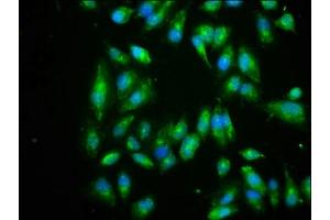 Immunofluorescence staining of Hela cells with ABIN7152162 at 1:266, counter-stained with DAPI. (EIF3I antibody  (AA 1-323))