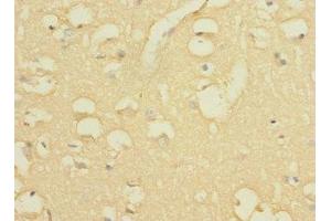 Immunohistochemistry of paraffin-embedded human brain tissue using ABIN7163876 at dilution of 1:100 (WBSCR17 antibody  (AA 101-300))