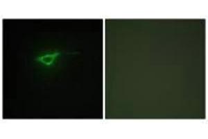 Immunofluorescence analysis of NIH/3T3 cells, using Collagen XX α1antibody.