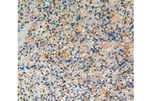 Used in DAB staining on fromalin fixed paraffin- embedded kidney cancer tissue (BCL2L1 antibody  (AA 2-212))
