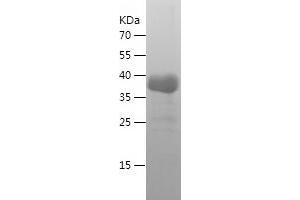 Western Blotting (WB) image for Cross Linked N-Telopeptide of Type I Collagen (NTX-I) (AA 23-161) protein (His-IF2DI Tag) (ABIN7122499) (NTX-I Protein (AA 23-161) (His-IF2DI Tag))