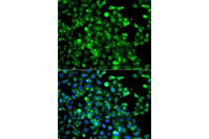 Immunofluorescence analysis of A549 cell using CAPN5 antibody. (Calpain 5 antibody)