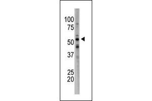 The anti-BACE1B Ctr Pab (ABIN6242328 and ABIN6578968) is used in Western blot to detect BACE1B in mouse brain tissue lysate. (BACE1B (AA 169-198) antibody)