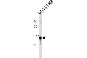 Western Blotting (WB) image for anti-Tumor Protein D52-Like 3 (TPD52L3) antibody (ABIN3004710) (TPD52L3 antibody)