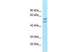 ATG16L1 antibody used at 1 ug/ml to detect target protein. (ATG16L1 antibody)