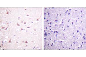 Peptide - + (DRP2 antibody  (Thr514))