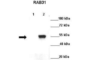 Lanes : Lane 1: GFP-Rab5 transfected cos cellsLane 2: GFP-Rab31 transfected cos cells  Primary Antibody Dilution :  1:500   Secondary Antibody : Goat anti rabbit-HRP  Secondary Antibody Dilution :  1:5000  Gene Name : RAB31  Submitted by : Ruth Herbst, Medical University Vienna (RAB31 antibody  (C-Term))