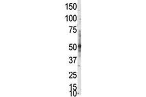 Western blot analysis of PRMT3 antibody in whole HL-60 cell lysate