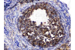 Immunohistochemistry (IHC) image for anti-Chaperonin Containing TCP1, Subunit 5 (Epsilon) (CCT5) (AA 443-535) antibody (ABIN4886515)