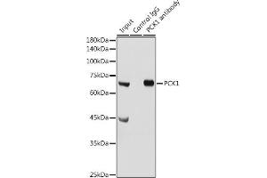 Immunoprecipitation analysis of 300 μg extracts of Mouse liver cells using 3 μg PCK1 antibody (ABIN3022753, ABIN3022754, ABIN3022755 and ABIN6219210). (PCK1 antibody  (C-Term))