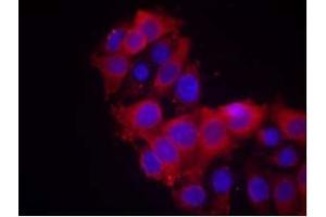Image no. 2 for anti-VEGF Receptor 2 (VEGFR2) (AA 1212-1216) antibody (ABIN197239) (VEGFR2/CD309 antibody  (AA 1212-1216))