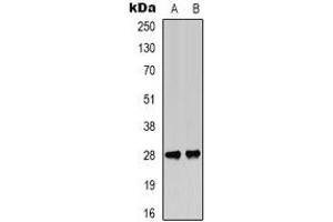 Western blot analysis of BCL2 (pT56) expression in Jurkat (A), rat muscle (B) whole cell lysates. (Bcl-2 antibody  (pSer56))