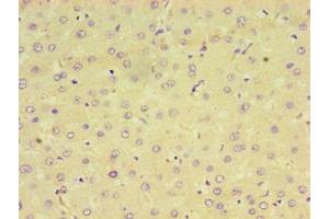 Immunohistochemistry of paraffin-embedded human liver tissue using ABIN7164598 at dilution of 1:100 (CPVL antibody  (AA 23-476))
