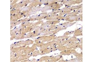 Immunohistochemistry of paraffin-embedded Rat heart using PSEN2 Polyclonal Antibody at dilution of 1:100 (40x lens). (Presenilin 2 antibody)