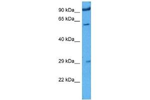 Host:  Rabbit  Target Name:  IGF2BP1  Sample Tissue:  Rat Skeletal Muscle  Antibody Dilution:  1ug/ml (IGF2BP1 antibody  (N-Term))