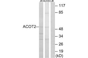 Western blot analysis of extracts from Jurkat cells and HuvEc cells, using ACOT2 antibody. (ACOT2 antibody  (Internal Region))