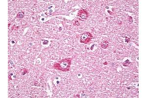 Anti-DACT1 / DAPPER antibody IHC of human brain, cortex neurons. (DACT1 antibody  (AA 725-775))