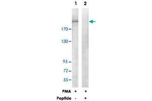 Western blot analysis of extracts from HepG2 cells, treated with PMA (125 ng/mL, 30 mins), using ITGB4 polyclonal antibody . (Integrin beta 4 antibody)