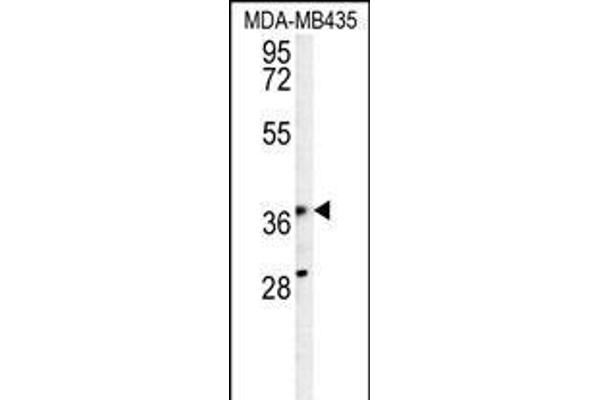 PRPSAP1 antibody  (N-Term)