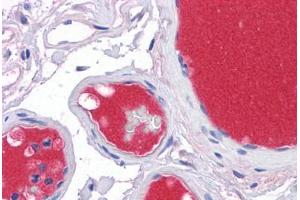 Human Vessels: Formalin-Fixed, Paraffin-Embedded (FFPE) (C3 antibody  (AA 1534-1645))