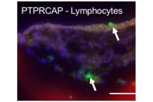 PTPRCAP antibody  (AA 125-206)