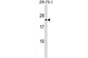 Western Blotting (WB) image for anti-Transmembrane Emp24 Protein Transport Domain Containing 3 (TMED3) antibody (ABIN2999507)