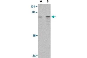Western blot analysis of DDX3X in HepG2 cell lysate with DDX3X polyclonal antibody  at (A) 1 and (B) 2 ug/mL . (DDX3X antibody  (Internal Region))
