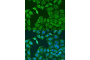 Immunofluorescence analysis of U2OS cells using AANAT antibody (ABIN6293599) at dilution of 1:100. (AANAT antibody)