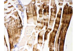 IHC analysis of ACTN3/Alpha Actinin 3 using anti- ACTN3/Alpha Actinin 3 antibody . (ACTN3 antibody  (C-Term))