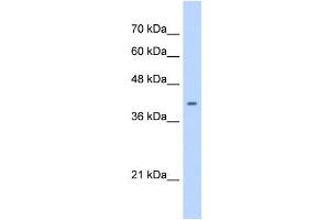 ST6GALNAC6 antibody used at 0. (ST6GALNAC6 antibody  (C-Term))
