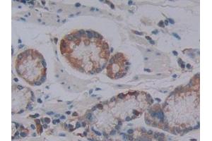 Used in DAB staining on fromalin fixed paraffin- embedded stomach tissue (LOXL4 antibody  (AA 479-756))